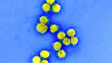 A transmission electron micrograph of SARS-CoV-2 virus particles. Courtesy of the National Institute of Allergy and Infectious Diseases.