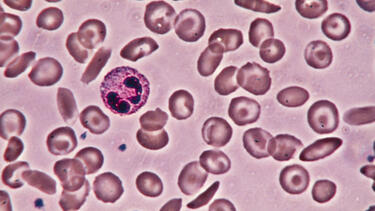 An image of blood cells under a microscope
