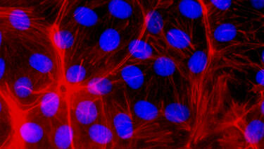 Confocal Fluorescence Microscopy of CRISPR-generated knockout cells.
