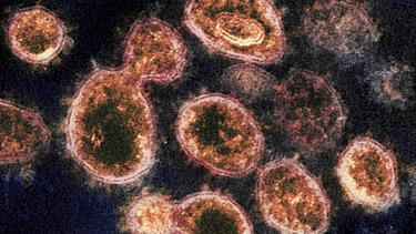 A microscope image of the virus that causes COVID-19