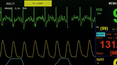 Screen of heart monitor