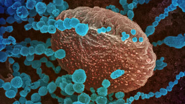 Coronavirus emerging from the surface of a cell.