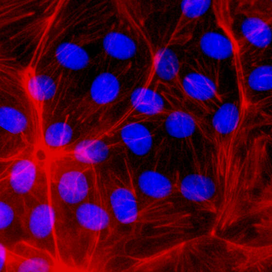 Confocal Fluorescence Microscopy of CRISPR-generated knockout cells.