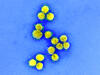 A transmission electron micrograph of SARS-CoV-2 virus particles. Courtesy of the National Institute of Allergy and Infectious Diseases.